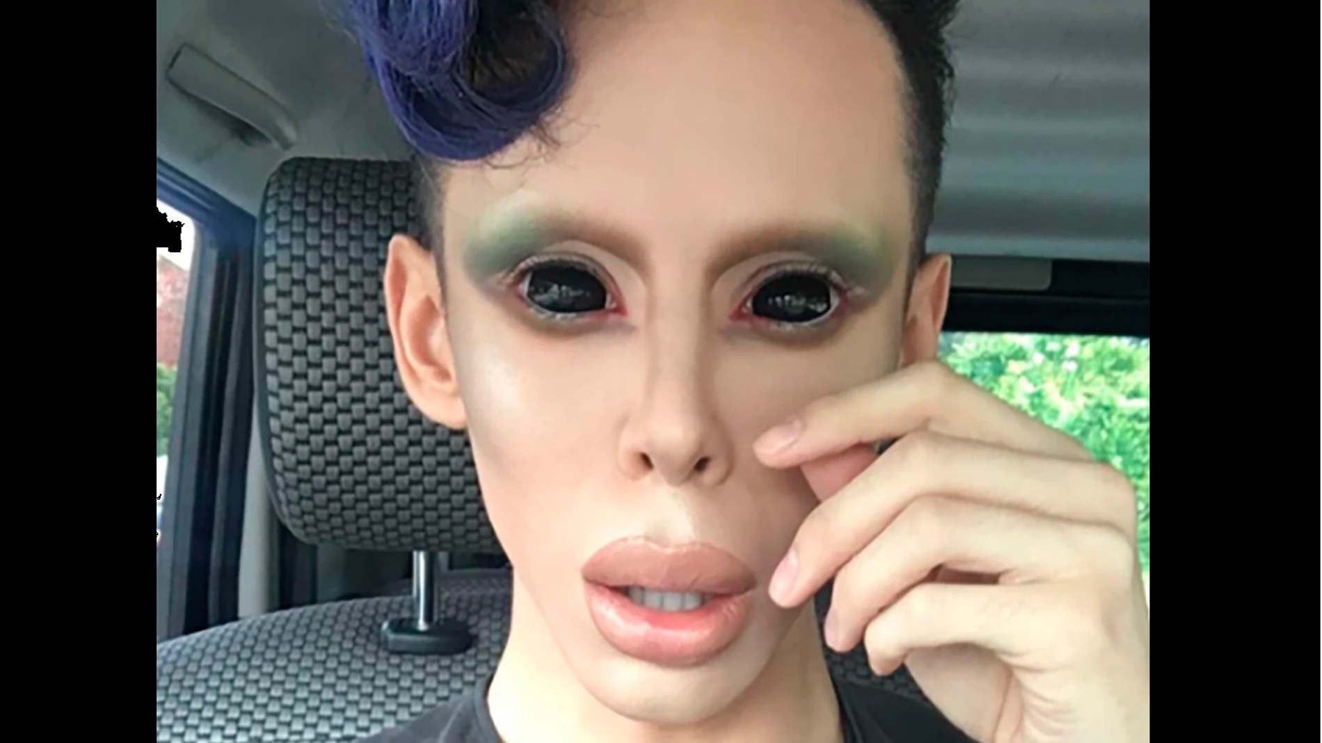 Vinny Ohh, el joven que se ha transformado en 'alien' Vinny Ohh, el joven que se ha transformado en 'alien'