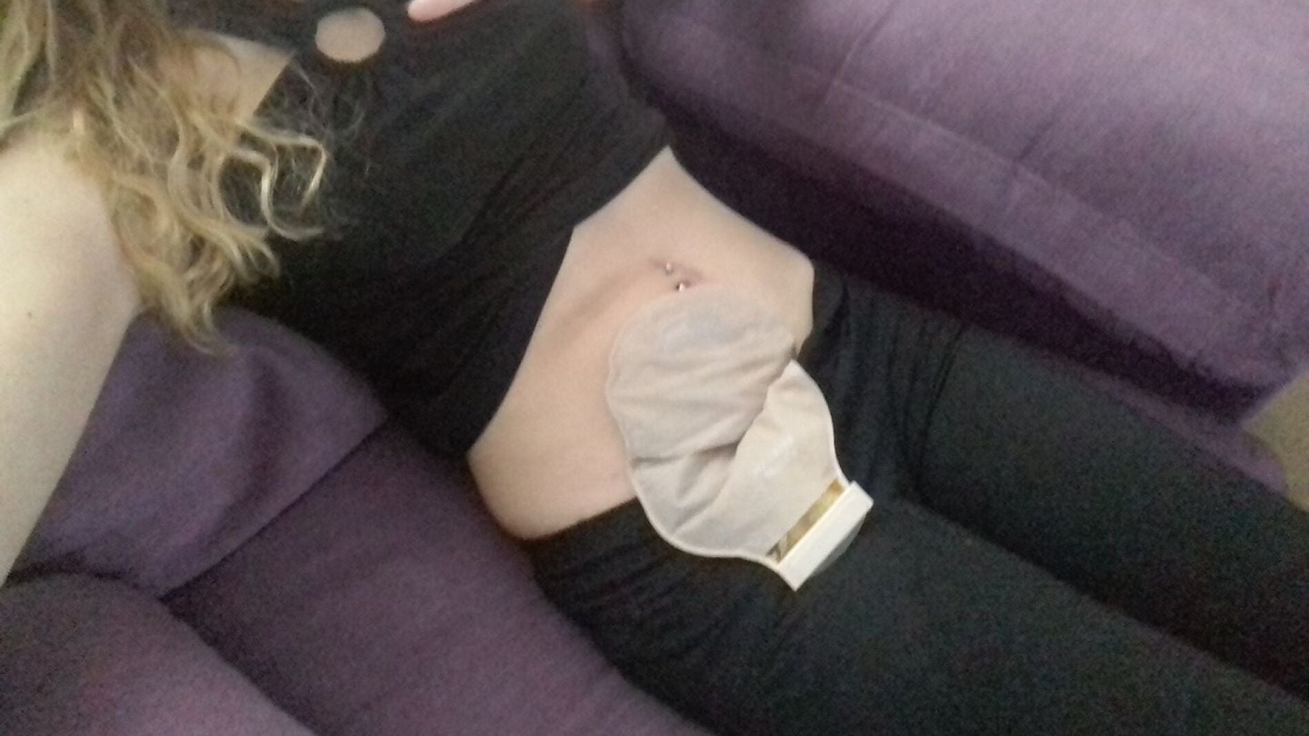 Paige Dease muestra la bolsa de colostom&iacute;a con la que vive