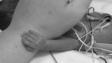 La mano de la enfermera junto a la de la bebé prematura