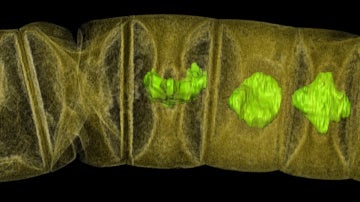 Radiografía del fósil de alga roja