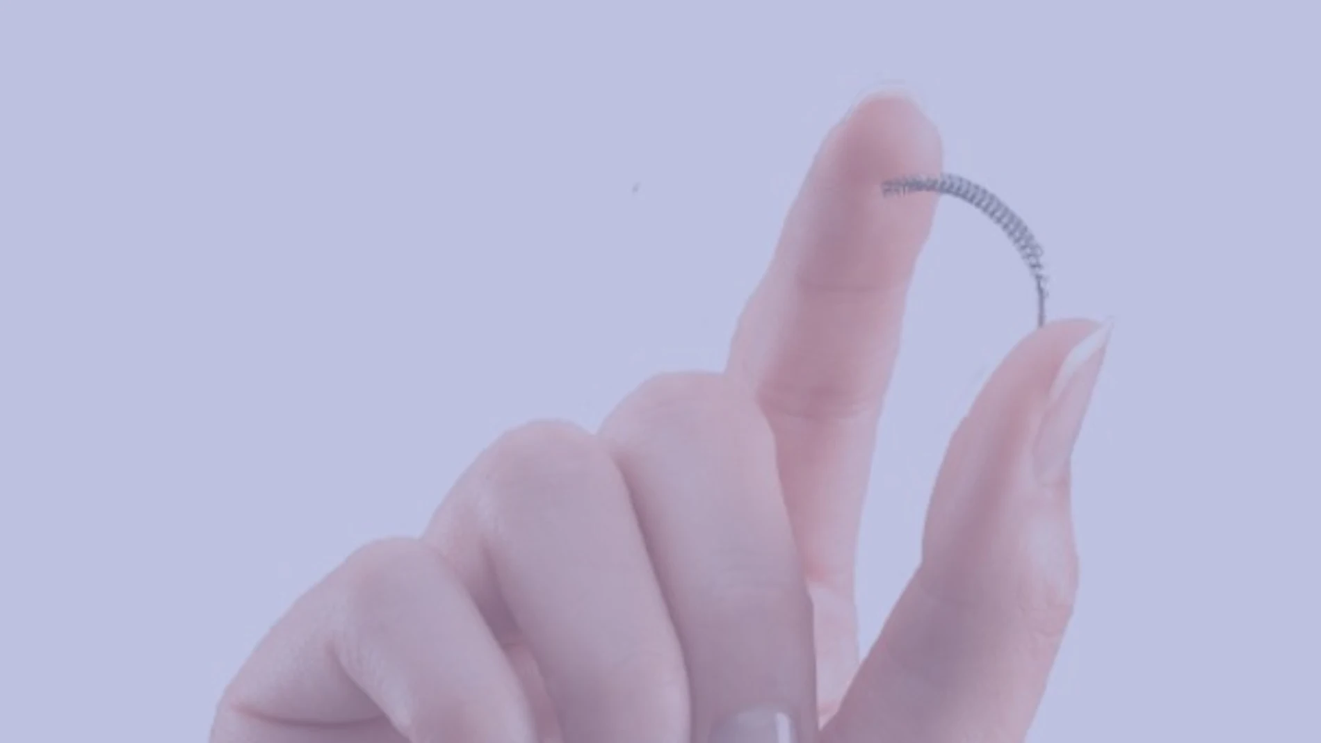 Essure es un pequeño muelle que se usa como anticonceptivo Essure es un pequeño muelle que se usa como anticonceptivo