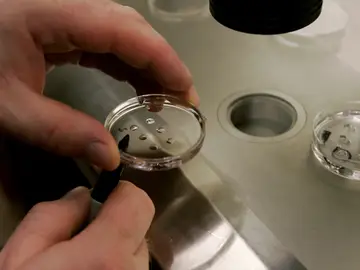 Fecundación in vitro Fecundación in vitro
