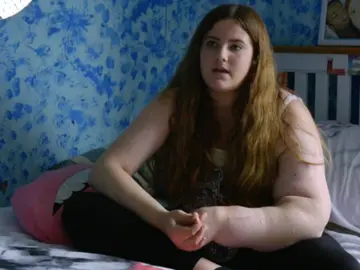 Leah Hardcastle la joven con 14 años a la que no le para de crecer el brazo Leah Hardcastle la joven con 14 años a la que no le para de crecer el brazo