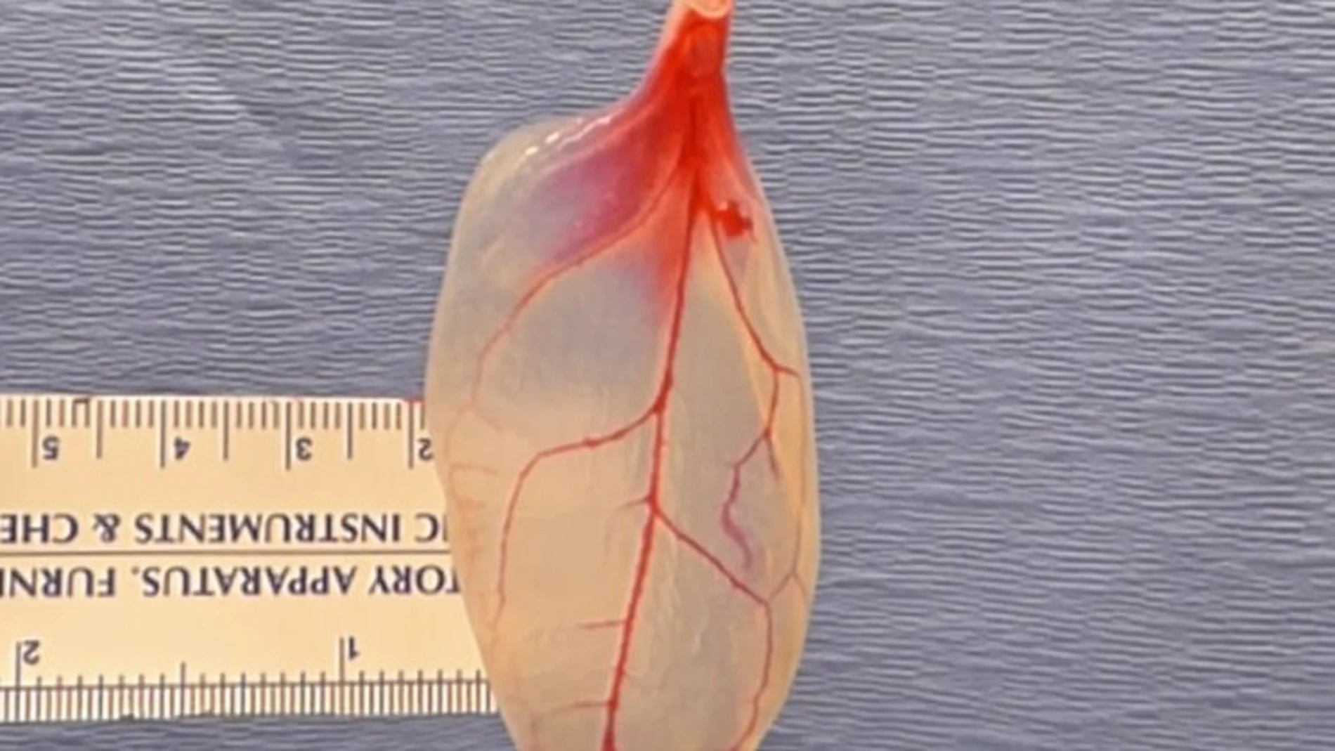 Las espinacas podrían remplazar el tejido vascular humano Las espinacas podrían remplazar el tejido vascular humano