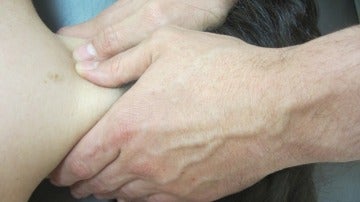 La fisioterapia mejora el sindrome del tunel del carpo en mujeres