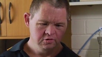 El hombre con síndrome de Down agredido en un centro para dispacitados