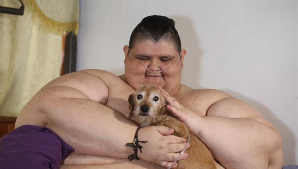 Juan Pedro, el hombre más obeso del mundo, será operado