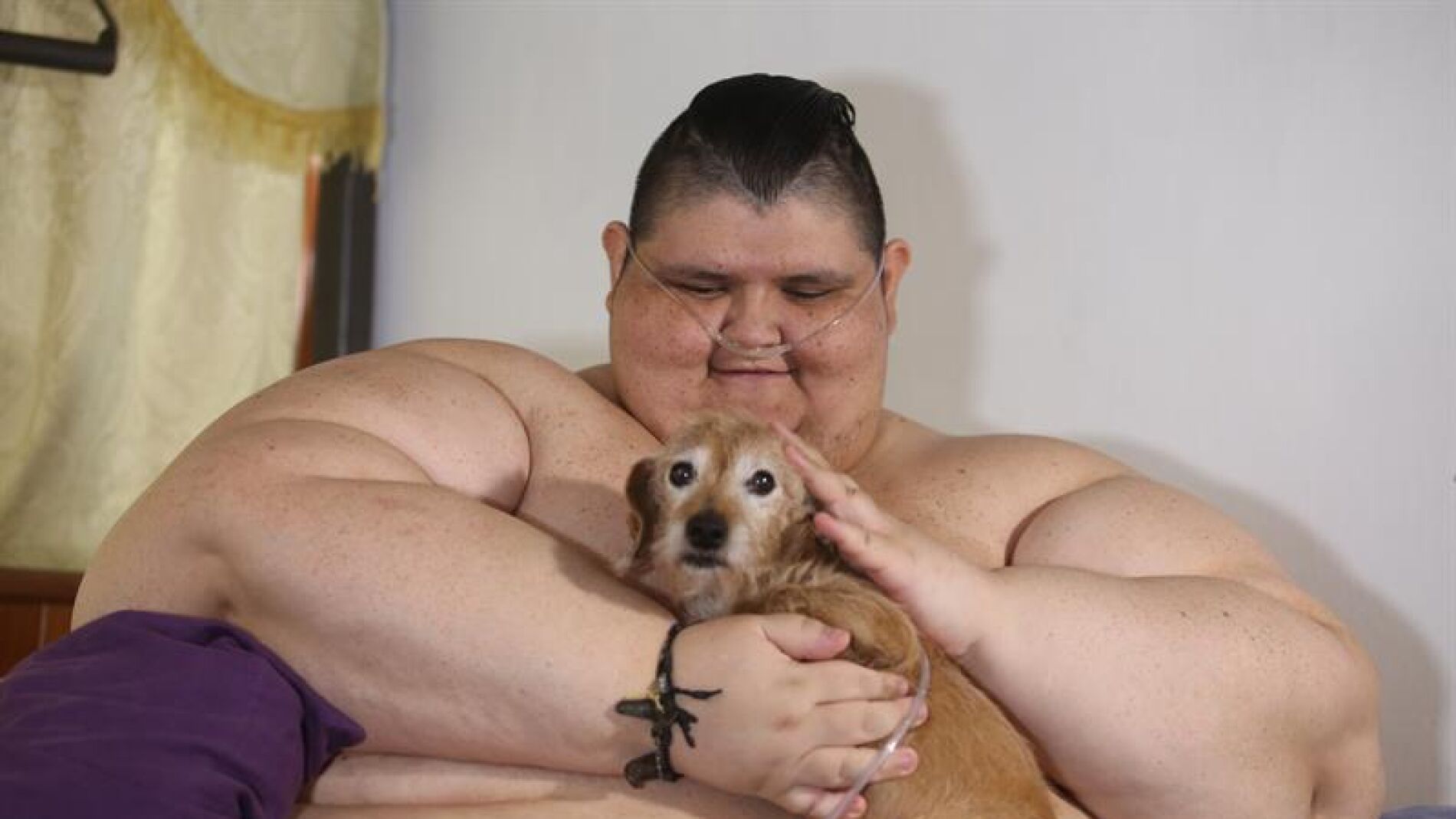 Juan Pedro, el hombre m&aacute;s obeso del mundo, ser&aacute; operado