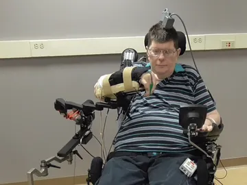 Bill Kochevar probando la neuroprótesis Bill Kochevar probando la neuroprótesis