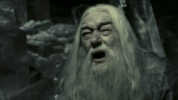 Dumbledore también sufre