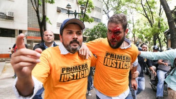 Un diputado venezolano es ayudado en la marcha opositora