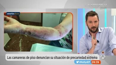 Una camarera, despedida después de sufrir quemaduras graves cuando limpiaba una plancha de cocina sin los medios adecuados