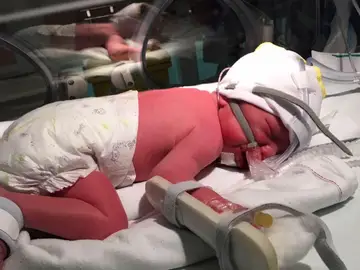 Una mujer porta a uno de sus bebés fallecidos para que sobreviva el otro Una mujer porta a uno de sus bebés fallecidos para que sobreviva el otro