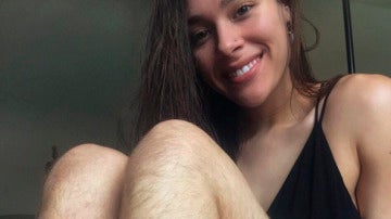 La bloguera publica una foto de sus piernas