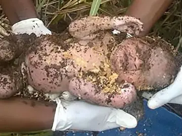 Bebé rescatado con vida en Sudáfrica Bebé rescatado con vida en Sudáfrica
