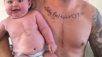 Un padre se tatúa la misma cicatriz que su hijo para demostrarle que no está solo