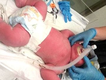 Bebé nacido con más de 7 kilos en Nueva Zelanda