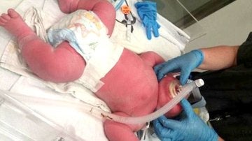 Bebé nacido con más de 7 kilos en Nueva Zelanda