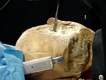Robot cirujano Robot cirujano