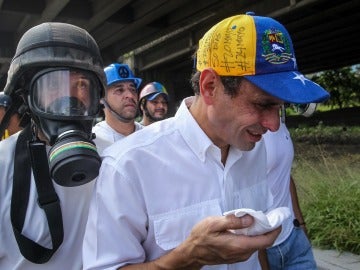 El opositor venezolano Henrique Capriles tras ser herido en una protesta