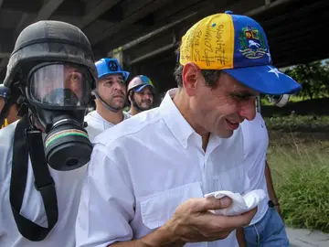 El opositor venezolano Henrique Capriles tras ser herido en una protesta El opositor venezolano Henrique Capriles tras ser herido en una protesta