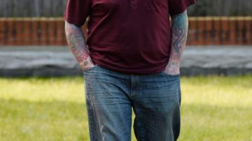 El hombre con más tatuajes de Reino Unido podría perder el brazo al implantarse un puño americano