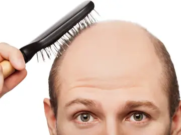 Un calvo peinándose Un calvo peinándose