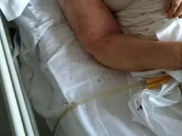 Indignación en Italia por paciente rodeada de hormigas en un hospital Indignación en Italia por paciente rodeada de hormigas en un hospital