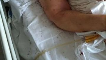 Indignación en Italia por paciente rodeada de hormigas en un hospital