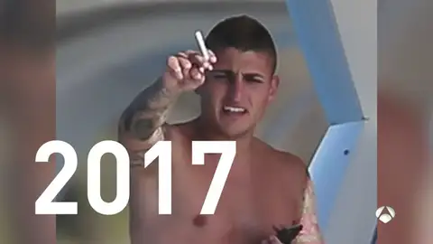 VerrattiFumaA3D VerrattiFumaA3D