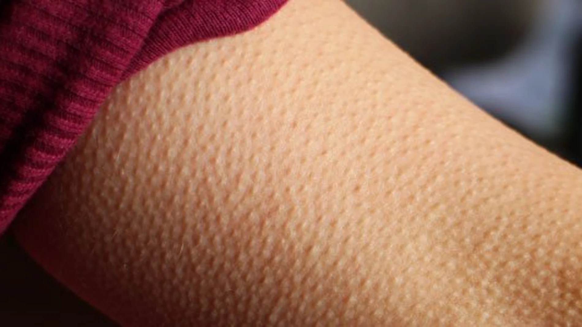 Piel de gallina Piel de gallina