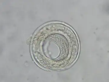 Angiostrongylus cantonensis Angiostrongylus cantonensis