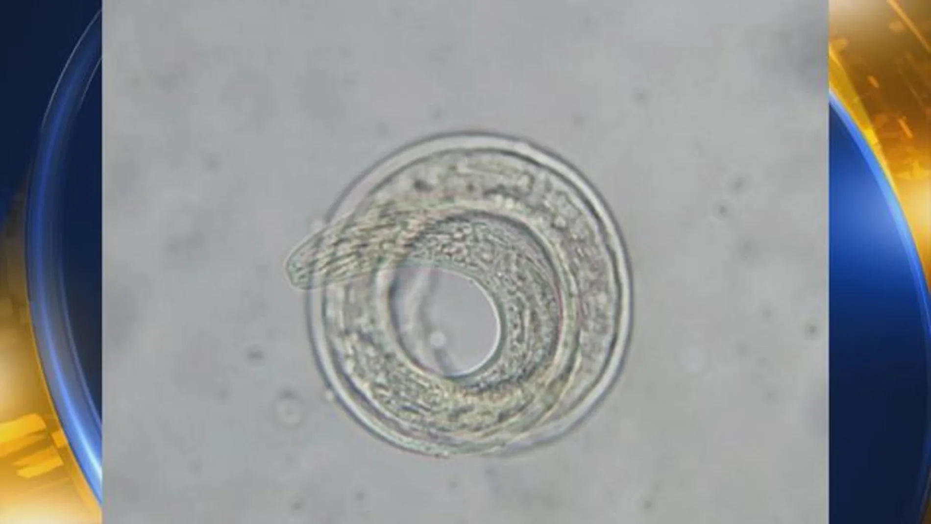 Angiostrongylus cantonensis Angiostrongylus cantonensis