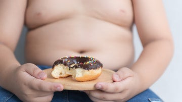 Hallados nuevos genes involucrados en la obesidad infantil