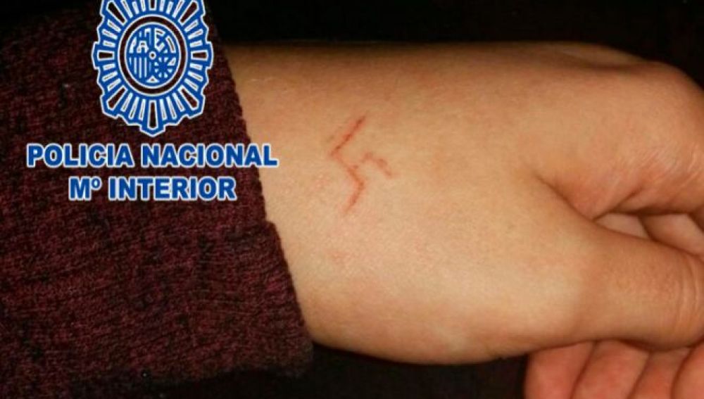 La esvástica grabada en la joven