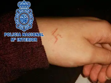 La esvástica grabada en la joven La esvástica grabada en la joven