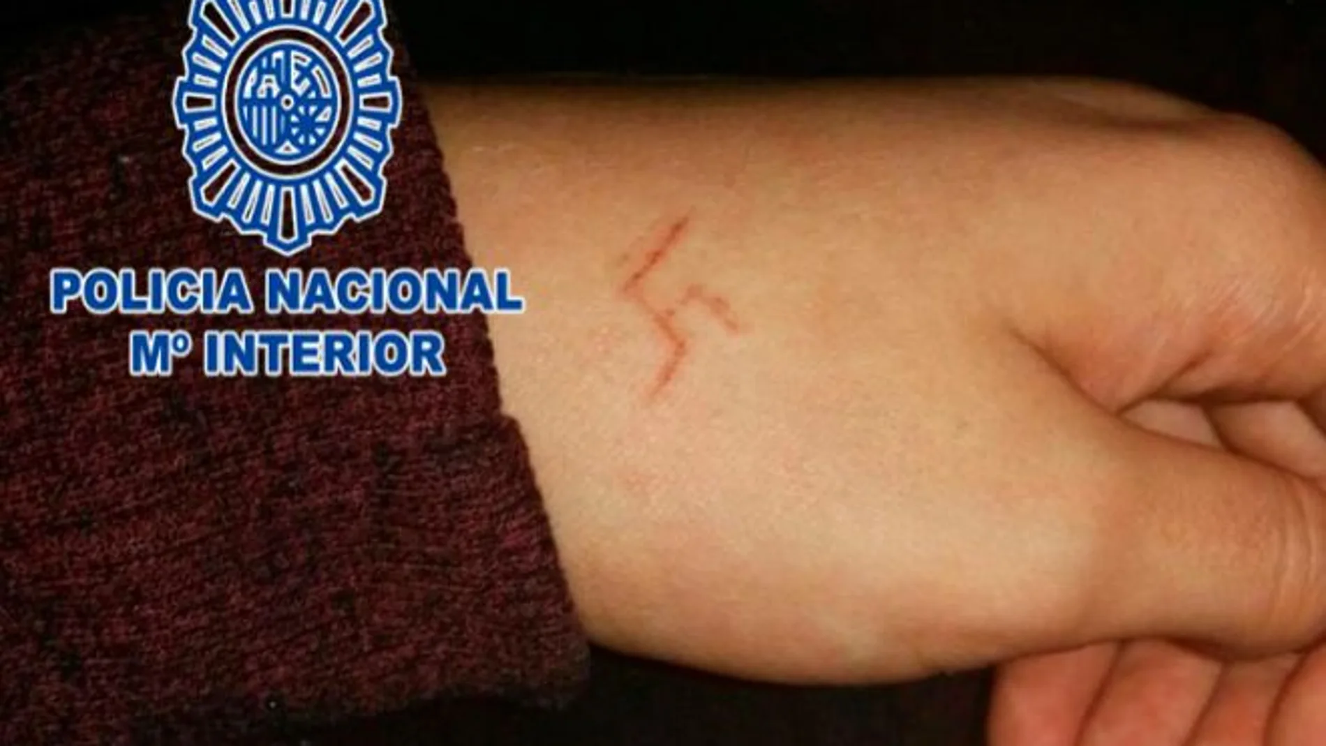 La esvástica grabada en la joven La esvástica grabada en la joven