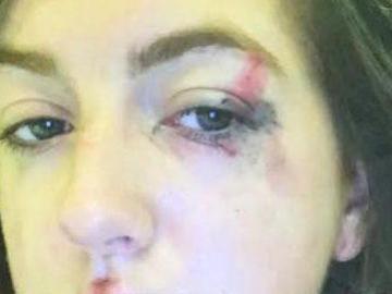Emily Campbell tras el ataque en su casa