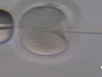 ¿Cuáles son los requisitos para donar óvulos? ¿Cuáles son los requisitos para donar óvulos?