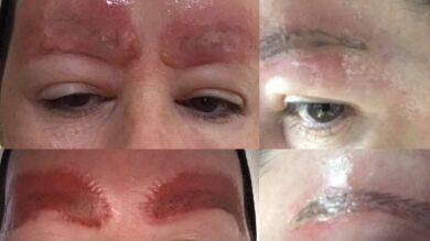 Una mujer advierte de los riesgos de hacerse un tatuaje tras perder sus cejas debido a una infección