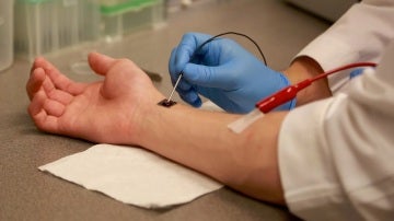 Nanochip en un paciente