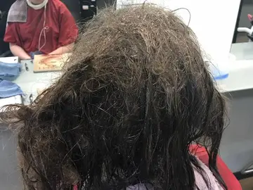 Estado del pelo con el que llegó la adolescente deprimida Estado del pelo con el que llegó la adolescente deprimida