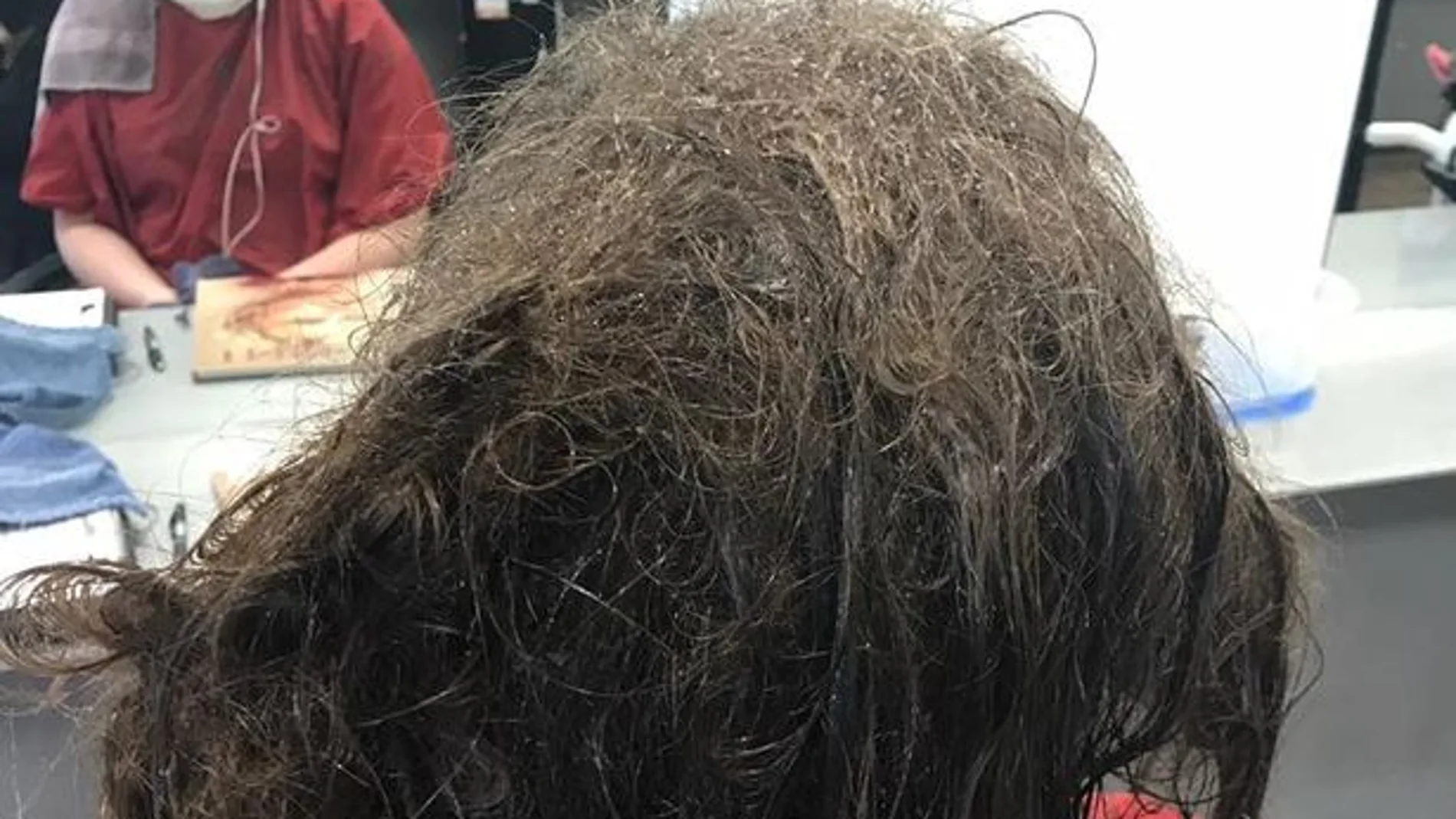 Estado del pelo con el que llegó la adolescente deprimida Estado del pelo con el que llegó la adolescente deprimida