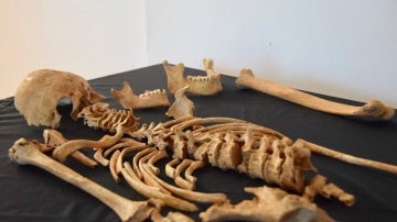 Restos humanos encontrados en la excavación