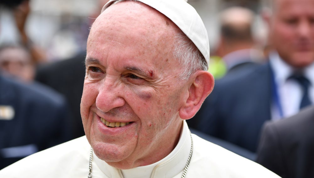 El Papa Francisco sufre una herida tras golpearse con el papamóvil