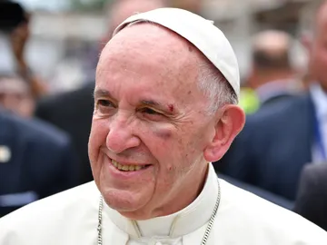 El Papa Francisco sufre una herida tras golpearse con el papamóvil El Papa Francisco sufre una herida tras golpearse con el papamóvil
