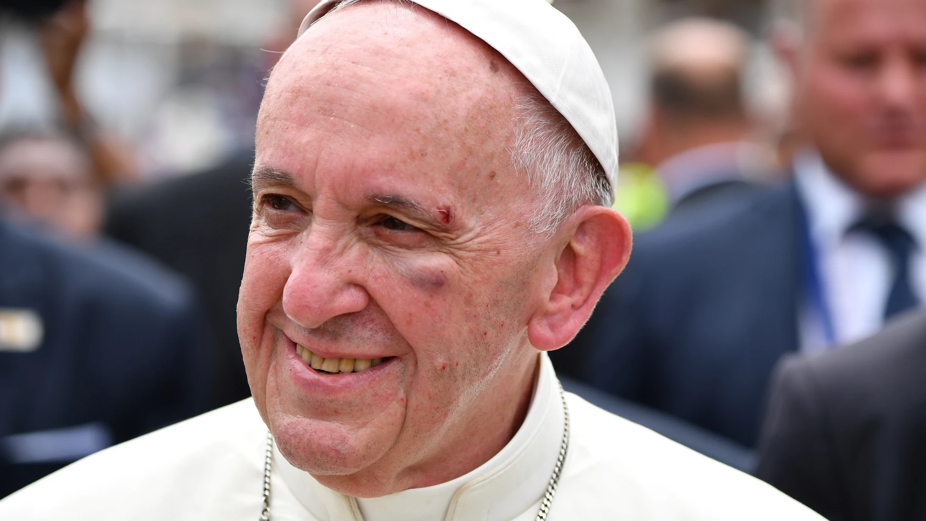 El Papa Francisco sufre una herida tras golpearse con el papamóvil El Papa Francisco sufre una herida tras golpearse con el papamóvil
