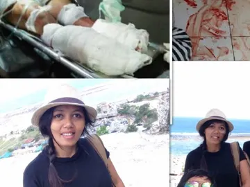 Un hombre le corta los pies a su mujer en Bali Un hombre le corta los pies a su mujer en Bali