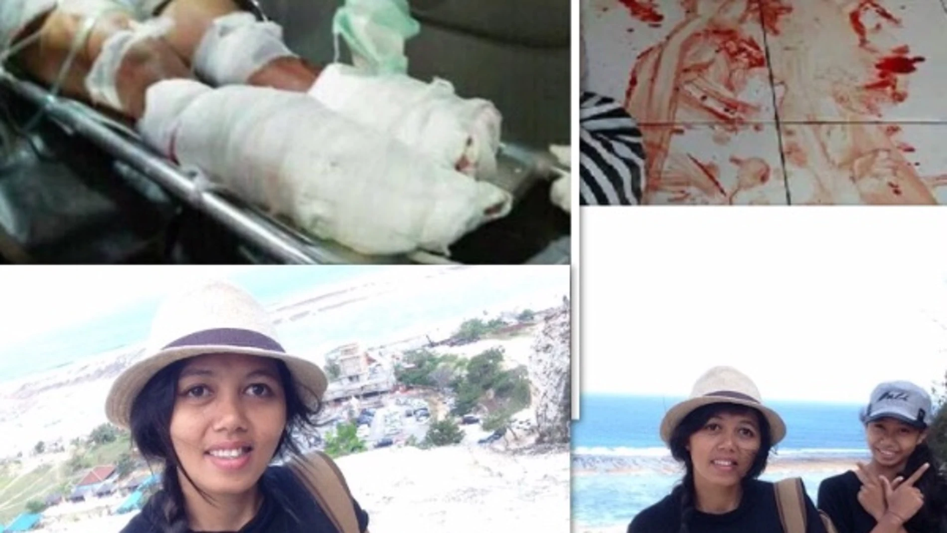 Un hombre le corta los pies a su mujer en Bali Un hombre le corta los pies a su mujer en Bali