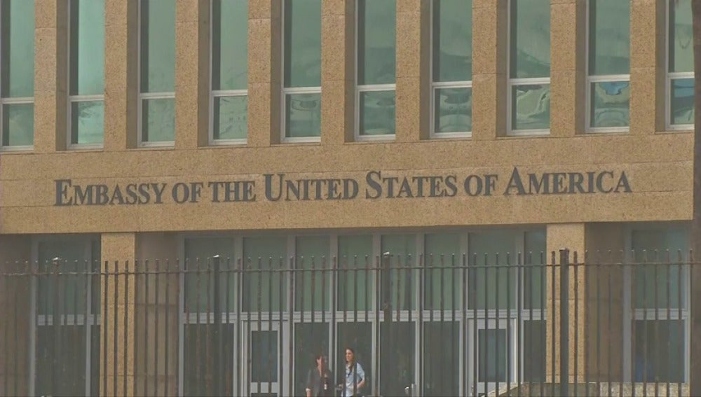 EE.UU. estudia cerrar su embajada en La Habana por presunto "ataque acústico"